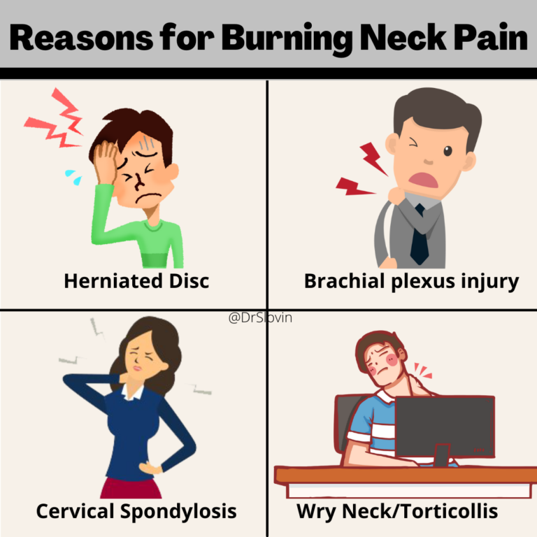 Burning Neck Pain What it is and How to Treat it Dr. Slovin